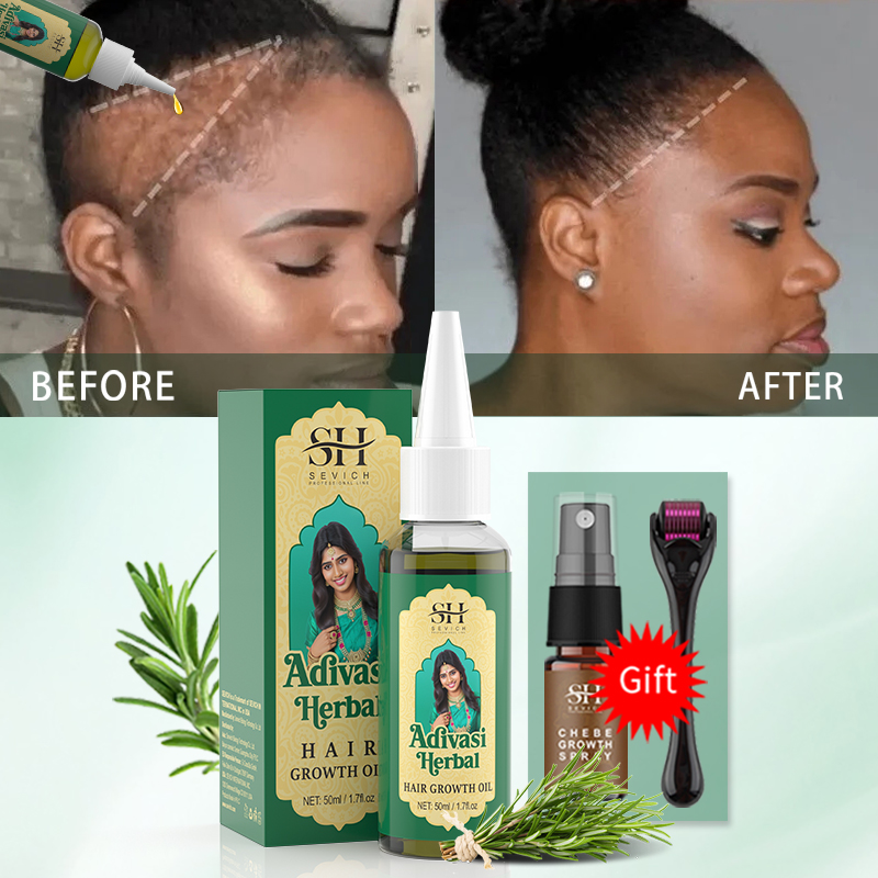 Ayurvedic Hair Growth Oil Indi – Ayurvedic & Herbal Wellness Kits recenzja i cena