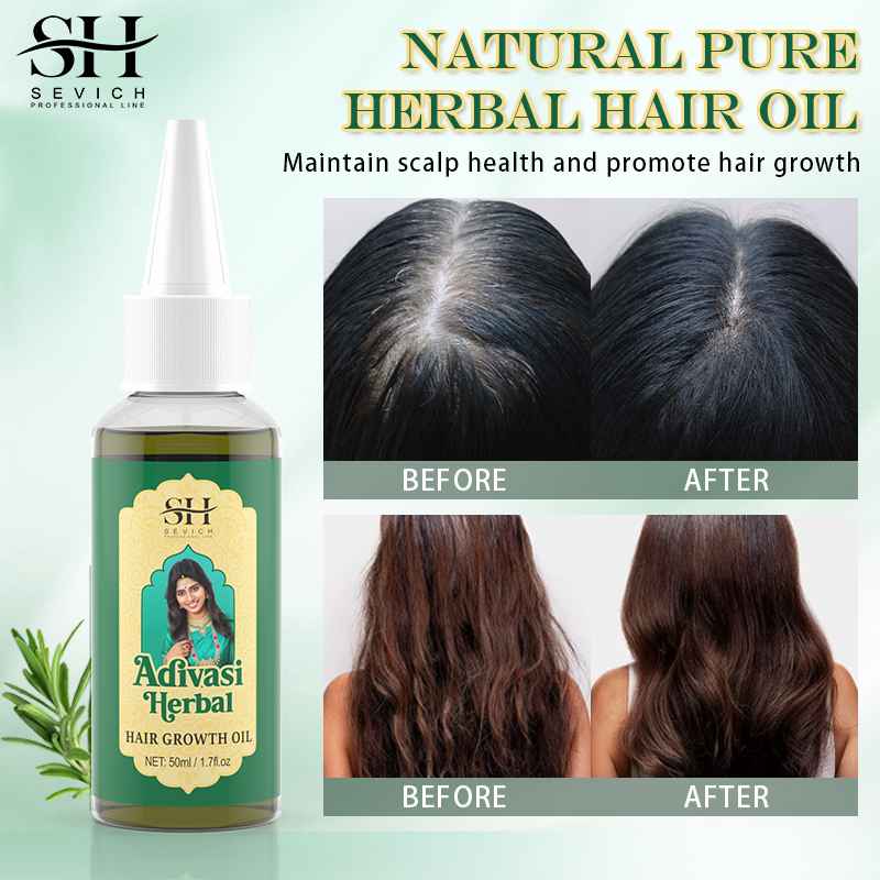Ayurvedic Hair Growth Oil Adiv – Ayurvedic & Herbal Wellness Kits recenzja i cena