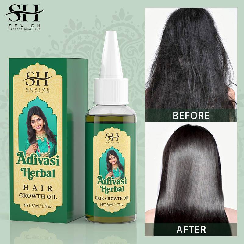 Sevich India Herbal Hair Growt – Ayurvedic & Herbal Wellness Kits recenzja i cena